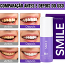 Branqueador Dental SMILE <span style="color: #000000;"><strong><span style="color: #ff2a00;">COMPRA 1 E LEVA 2!</span></strong></span>